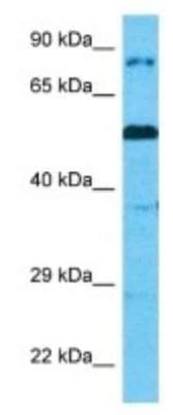 CAPN14 Rabbit anti-Human, Polyclonal, Novus Biologicals 25 &mu;g; Unconjugated:Antibodies,